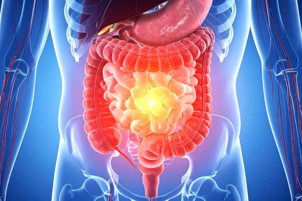  Tiêu hóa kém kéo dài có thể làm hệ vi sinh đường ruột khó duy trì trạng thái ổn định.